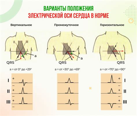 Определение перегара