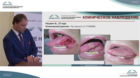 Определение эффективности лечения