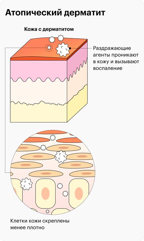 Оптимальная частота мытья при чесотке