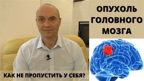 Опухоль в голове: проверяйте симптомы и обращайтесь к врачу