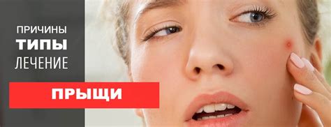 Основные методы избавления от прыщей на сосках и их эффективность