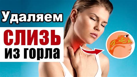 Основные методы лечения глистов в горле