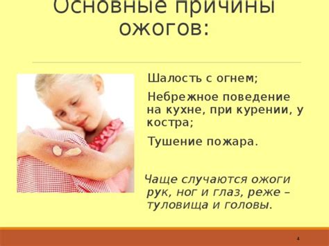 Основные ошибки при забинтовывании ожогов