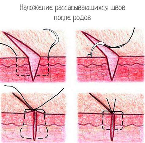 Основные правила поднятия коляски после кесарева