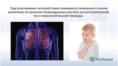 Основные признаки воспаления легочной ткани