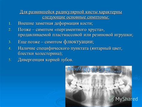 Основные симптомы хруста костей