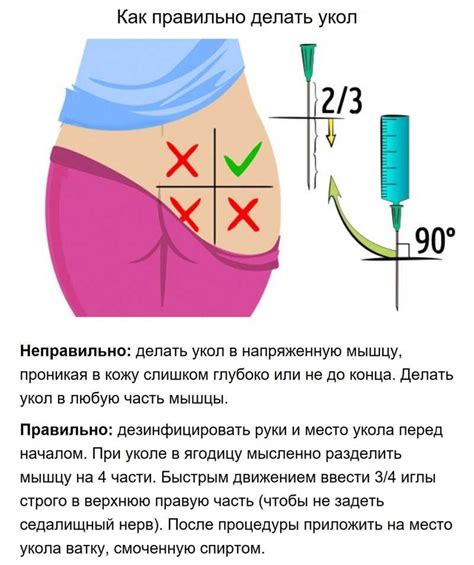 Особенности двух уколов в одну ягодицу