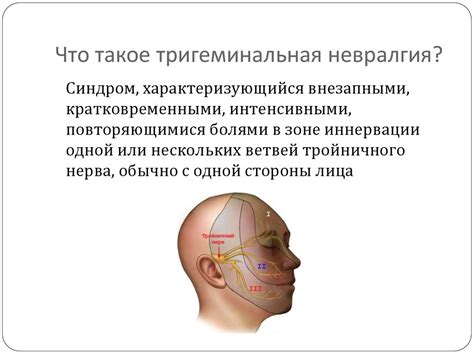 Особенности лечения застуды тройничного нерва