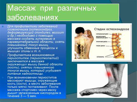 Особенности массажа при различных заболеваниях