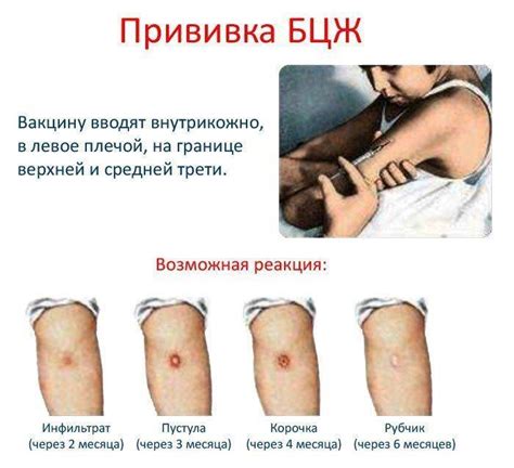Особенности прививки после болезни