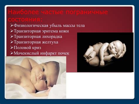 Особенности прохождения припухлости век у новорожденных