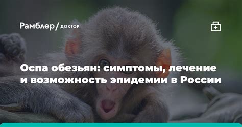 Оспа в России: угроза и эпидемии