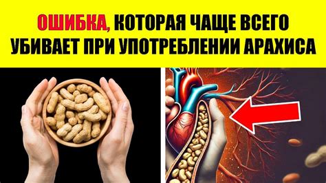 Осторожность при употреблении арахиса