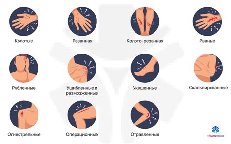 Ощущения при нанесении ножевого повреждения:
