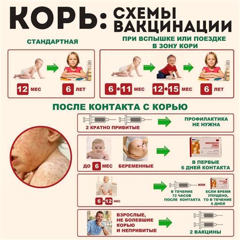 Первая прививка от кори