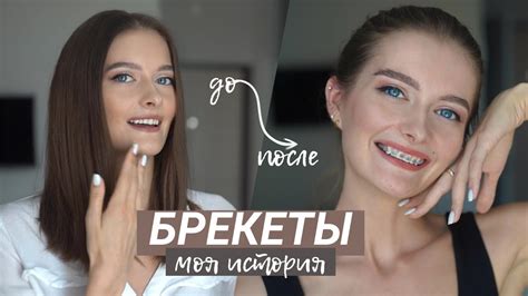 Первые ощущения встречи губ