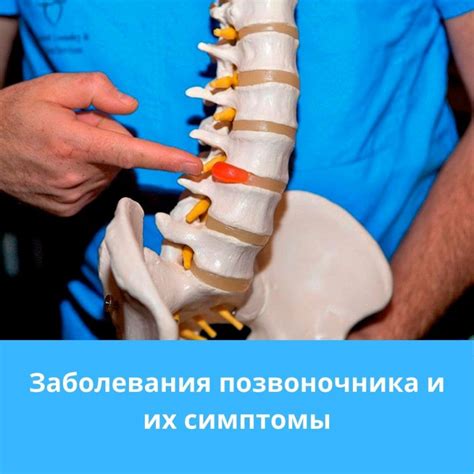Первые симптомы блокады в позвоночнике