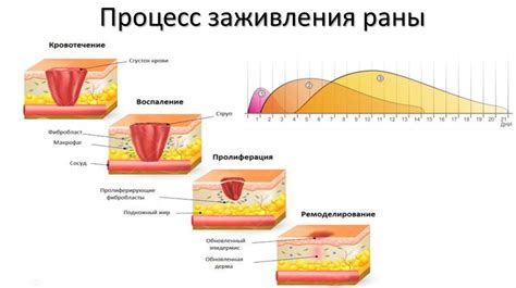 Период после прокалывания: заживление и уход