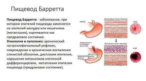 Питание после биопсии пищевода: