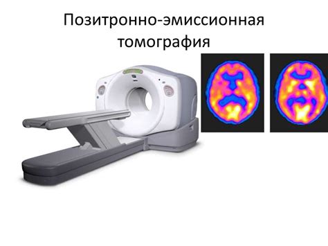 Плюсы и минусы Компьютерной Томографии