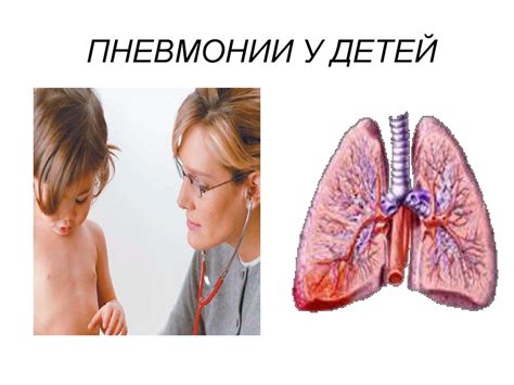 Пневмония у детей: основные признаки