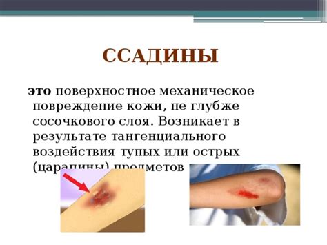 Повреждение защитного слоя кожи
