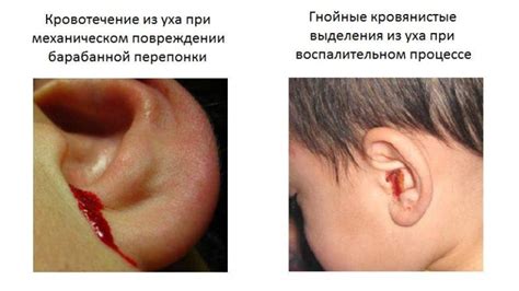 Повреждение ушей