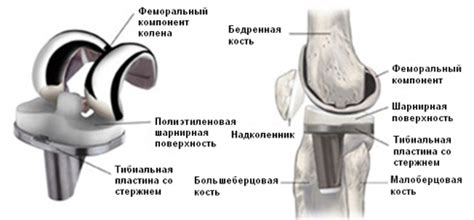 Поврежденные соединения