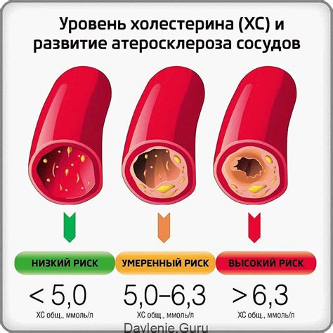 Повышение уровня холестерина в крови