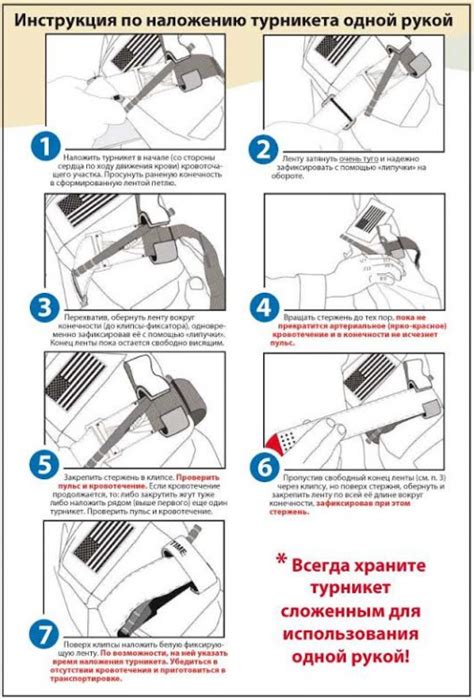 Подробная инструкция по накладыванию первичного жгута