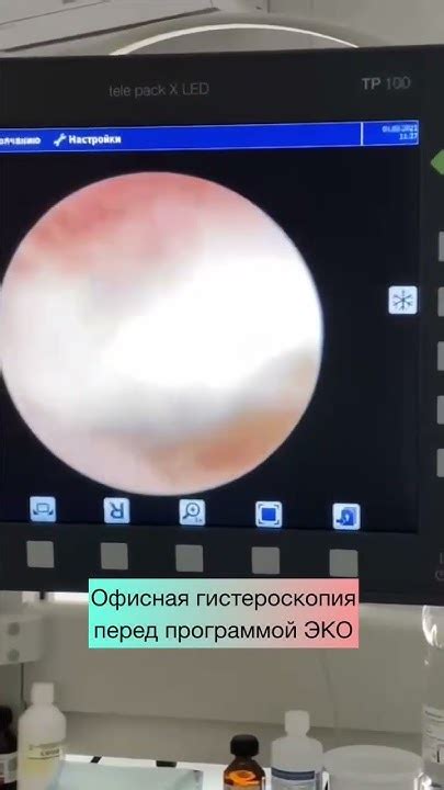 Показания для проведения гистероскопии перед ЭКО