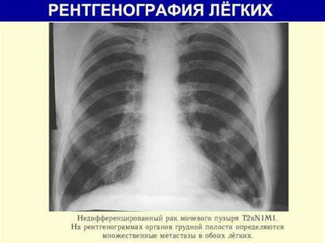 Польза рентгена для детей в возрасте 2 года