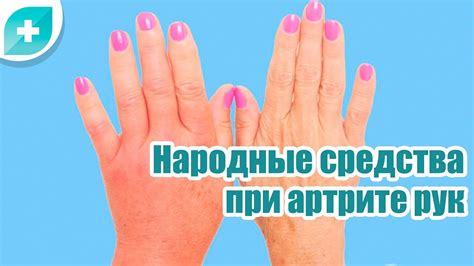 Популярные народные средства от боли в суставах пальцев рук