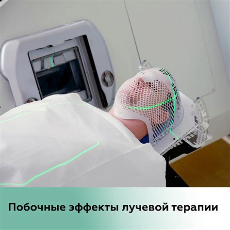 Последствия и побочные эффекты лучевой терапии после химиотерапии