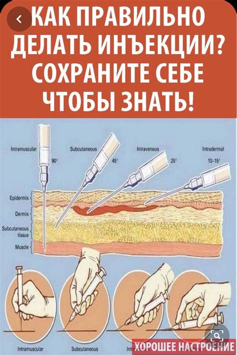 Последствия и риски при двух уколах в одну ягодицу