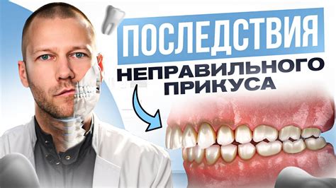 Последствия неправильного перевязывания