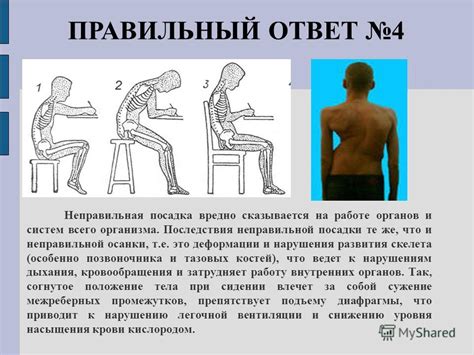 Последствия неправильной осанки
