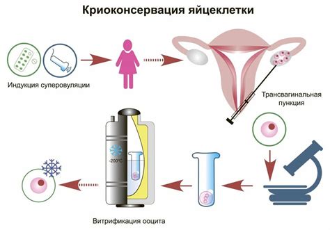Последующие шаги после забора яйцеклеток