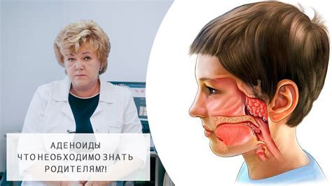 Почему у детей возникают аденоиды и как это проявляется