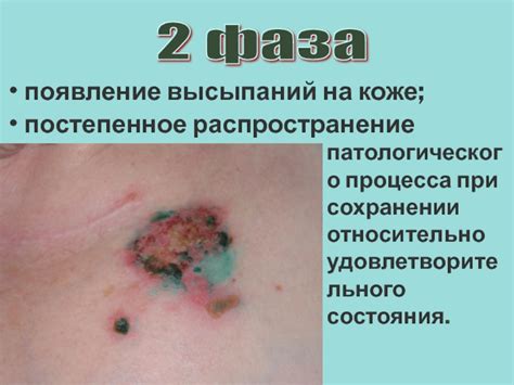 Появление высыпаний на коже