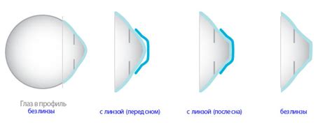 Правила использования ночных линз