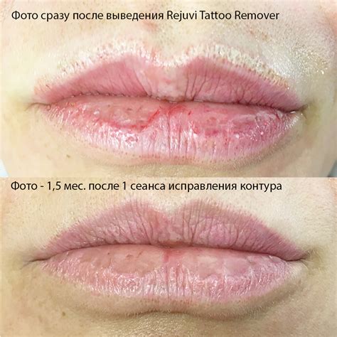 Правила ухода после перманентного макияжа губ