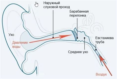Правильная процедура надевания ушей