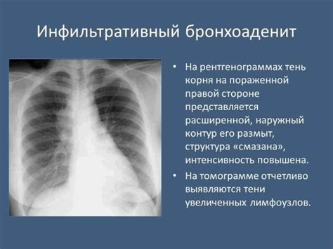 Правовой аспект проведения флюорографии без прописки