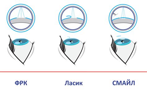 Практические ограничения зрения