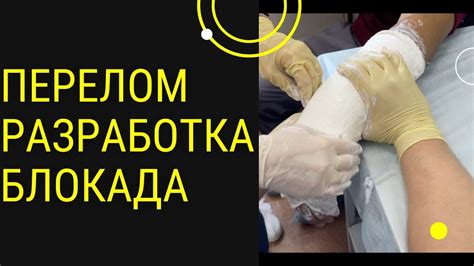 Предостережения и рекомендации во время бани после снятия гипса