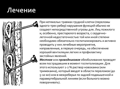 Предупреждение трещины в ребре
