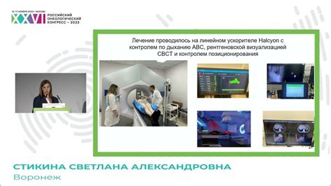 Преимущества КТ