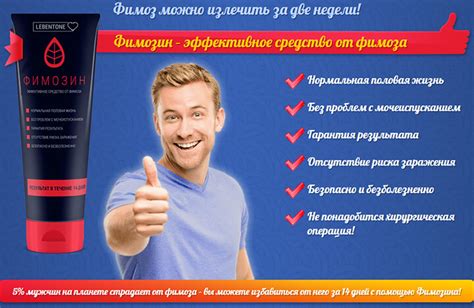 Преимущества без обрезания
