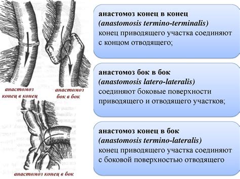 Преимущества использования анастомоза бок в бок